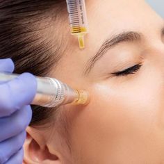 Microneedling with PRP Microneedling With Prp, Home Facial Treatments, Skin Needling, Cosmetic Clinic, Platelet Rich Plasma, Advanced Skin Care, Anti Aging Secrets, Uneven Skin Texture, Aesthetic Clinic