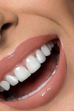 Teeth Whiting At Home, Teeth Aesthetic, Loose Tooth, Perfect Teeth, Yellow Teeth, Smile Teeth, Stronger Teeth, Oral Care Routine