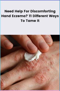 It is pretty understandable how dry, itchy, and inflamed skin on your hands negatively interferes with your daily activities. Here are dermatologists' approved tips to solve your problem. #handeczema #handatopicdermatitis #atopicdermatitis Inflammed Skin, Tighten Facial Skin, Hand Health, Inflamed Skin, Dry Hands, Luxury Skincare, Daily Activities, Hydrate Skin