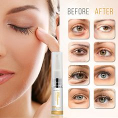 INSTANT EYEBAG REMOVER Anti Aging Reduce Dark Circles, Puffiness, Eye Bags, Wrinkles DERMAXGEN - Walmart.com Eye Bags Makeup, Instant Face Lift, Under Eye Wrinkles, Reduce Dark Circles, Face Wrinkles, Delicious Snacks, Eye Wrinkle