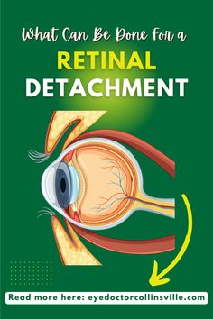 Ever wondered what those blurry shadows at the corners of your vision could mean? They might be signs of a more serious condition called retinal detachments. Let's delve deep into the anatomy of the eye and discover the causes, symptoms, and prevention of this vision-threatening disease. Stay informed and protect your precious sight! Types Of Surgery, Laser Surgery, Vision Loss, Dos And Don'ts