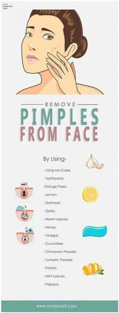 Discover effective methods on how to remove pimples from face and restore your skin's natural beauty. Embrace a clearer, happier face. To Remove Pimples, Warts On Hands, Home Remedies For Pimples, Remove Pimples, Skin Moles, Pimples Overnight, Pimples Remedies, Natural Acne Remedies, Types Of Acne