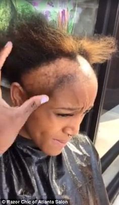 Atlanta hairstylist shares videos of clients suffering from hair loss due to weaves How To Weave Hair, New Hair Stylist, Conturing Makeup, Thinning Edges, Damage Hair