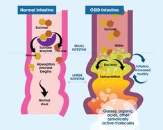 Read More about CSID - A Carbohydrate Digestive Disorder Csid Recipes, Healthy Gut Diet, Gut Diet, Failure To Thrive, Improve Your Gut Health, Lactose Intolerance, Gut Issues, Food Types