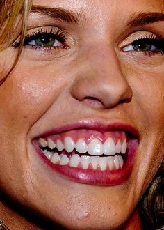 annalynne mccord Annalynne Mccord, Perfect Smile, Toothless, Body Positivity, Favorite Celebrities, Close Up, Fuel