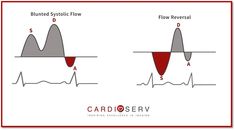 two diagrams showing the different stages of flow in an electrical device, and how they are used