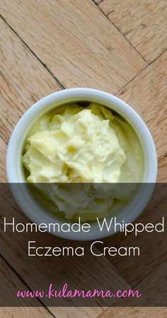 Homemade whipped eczema cream with essential oils by www.kulamama.com Coconut Oil Beauty, Anti Itch Cream, Diy Lotion, Homemade Lotion, Homemade Remedies, Coconut Tree, Beauty Recipe, Tree Diy, Essential Oil Recipes