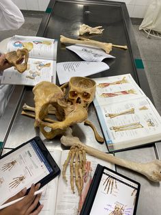 several human bones are displayed on a table with electronic devices and medical equipment in front of them