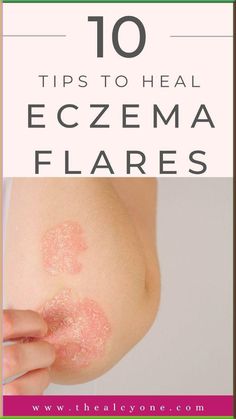 Struggling with eczema flare-ups? Discover 10 proven tips to soothe irritated skin and heal eczema fast. From skincare routines to natural remedies, these expert-backed strategies will help you manage and calm flare-ups effectively. Click to start your journey to healthier, happier skin! Cough Syrup Recipe, Health Herbs, Brightening Skincare, Diy Herbal Remedies, Skincare Routines, Sun Damaged Skin, Plant Based Skincare