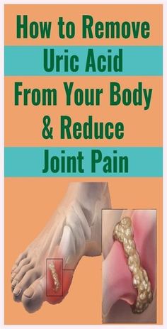 Body Flush, Organic Compounds, Health Remedies, Natural Food, Healthy Tips, Stay Fit, Pain Relief