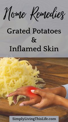 How to help sore, cracked & inflamed skin with a potato poultice. Cheap natural home remedies for inflamed & rash on skin. Tips how to use a potato poultice to help your skin heal literally overnight! (In our experience.) Also how to make all-natural, gentle Foaming hand soap that will keep your skin from breaking out again from toxic & harsh chemical soaps. Super simple natural Castile DIY foaming hand soap recipe that will save you money too. Home Remedies For Rashes, Aloe Vera For Sunburn, Foaming Hand Soap Dispenser, Home Remedies For Allergies