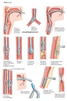 an image of different types of surgery