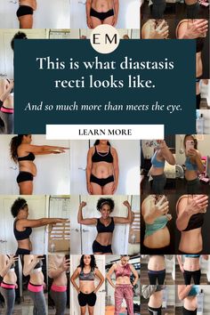 a collage of photos with the caption'this is what diastasis recti looks like and so much more than meets the eye '