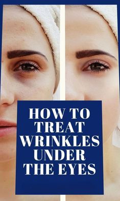 HOW TO TREAT WRINKLES UNDER THE EYES Diy Facial Moisturizer, Natural Wrinkle Remedies, Wrinkles On Face, Anti Aging Remedies, Diy Anti Aging