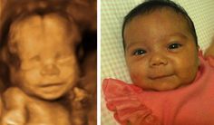 a baby is shown in two different pictures, one with an infant's face and the other without