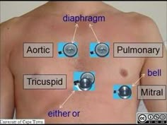 the diagram shows different types of diaphragm and fibrosis in men