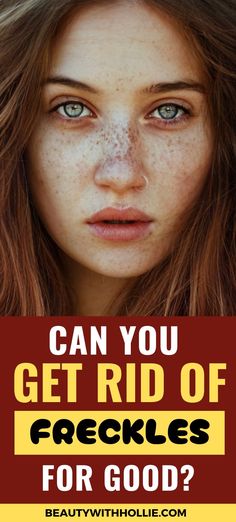 What are freckles and how to get rid of them for good? Body Tips Freckles On Face, Body Tips, Body Hacks