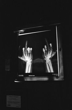 black and white photograph of two hands on a television screen