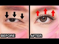 28 min🔥 Anti-Aging Eye Lifting Massage For Eye Bags, Sunken Eyes, Bigger Eyes, Dark Circles - YouTube Eyes Yoga, Exercise Face, Face Massages, Face Wrinkles Remedies, Eyes Bigger, Face Gym, Eyes Dark Circles, Sunken Eyes