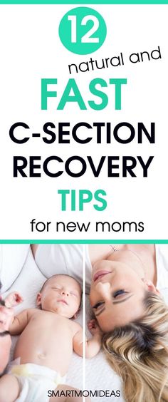 mother and baby sleeping together with text overlay that reads 12 natural and fast c - section recovery tips for new moms