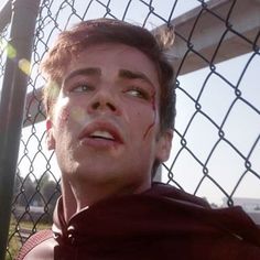 a man with blood on his face standing next to a fence