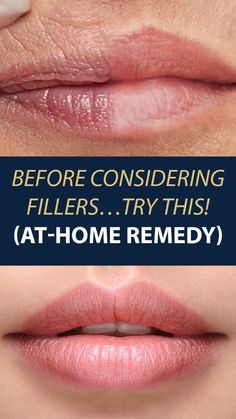 Makeup Tips To Look Younger, Wrinkles Remedies Face, Plump Lips Naturally, Mouth Wrinkles, Lip Wrinkles, Skin Care Wrinkles, Face Makeup Tips, Face Wrinkles, Skin Care Cream