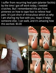 Loose Weight In A Week, Heel Pain, Health Info, Useful Life Hacks, Health Remedies, Natural Healing, Get Healthy, Natural Health, Home Remedies