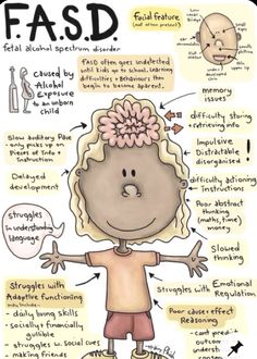 Fetal Alcohol Spectrum Disorder Symptoms, Fetal Alcohol Disorder, Learning Psychology, Fetal Alcohol Spectrum Disorder, Fetal Alcohol, Psychology Studies