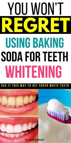 Try this hack for White teeth within 2 minutes | How to Whiten Teeth With Baking Soda 
Watch Free Video Now 

How To Use Baking Soda To Whiten Your Teeth: if you want to explore natural teeth whitening treatments, baking soda is a great option. Read on to know more about the benefits of using baking soda to get pearly white teeth. #teethwhitening #whiteteeth #remedies #homeremedies Peroxide Baking Soda Teeth, Does Baking Soda Whiten Teeth, Brushing Teeth With Baking Soda, Natural Ways To Whiten Teeth, Best Teeth Whitening Toothpaste, Baking Soda And Peroxide Teeth, Tooth Whitening Diy, At Home Teeth Whitening Diy, Whitened Teeth