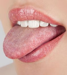 Tongue Ulcer Remedies, Ulcer Remedies, Burning Mouth, Mouth References, Remedies For Dry Mouth, Mouth Problems, Homemade Mouthwash, Mouth Health, Dental Facts