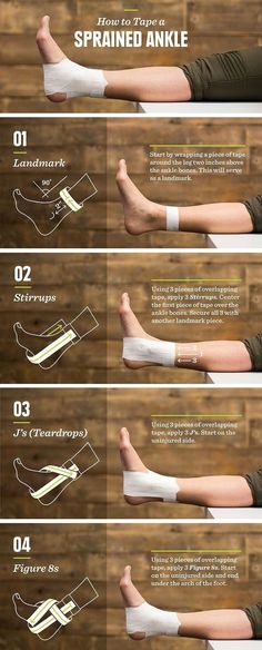 Sprained Ankle Anti Aging Cream Recipe, Anti Aging Quotes, Aging Quotes, Anti Aging Creme, Seni Dan Kraf, Survival Life Hacks, Trening Fitness, Sprained Ankle, Anti Aging Beauty