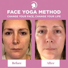 Aging Healthy, Facial Exercise, Face Gym, Face Yoga Method, Pilates Stretches, Face Tone, Face Yoga Exercises, Reverse Aging, Forehead Wrinkles