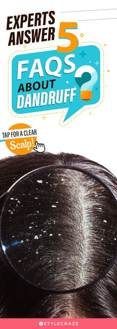 Experts Answer 5 FAQs About Dandruff: Tired of dandruff? Get expert insights on this scalp condition with answers to 5 common questions. Healthy Vag, Womens Health Care, Womens Health Magazine, Common Questions, Health Lifestyle, Grow Hair, Herbal Remedies