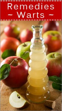 ACV Cider Vinegar Benefits, Warts Remedy, Apple Cider Vinegar Benefits, Apple Cider Benefits, Home Remedies For Hair, Homemade Beauty Products, Shampoos