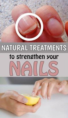 This video provides a comprehensive guide to maintaining healthy and strong nails. From proper nail care techniques to the best products to use, this video c... Tongue Health, Broken Nails, Nail Care Tips, Brittle Nails, Nail Growth, Nails Polish, Nail Strengthener, Strong Nails, Nail Health