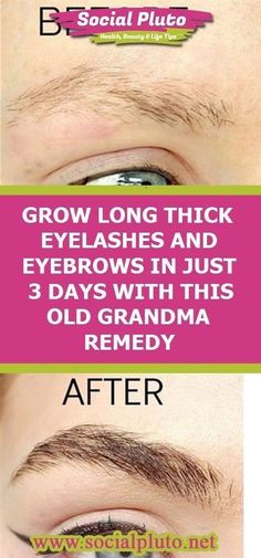 Grow Longer Thicker Eyelashes, Grow Eyebrows Faster, Grow Eyebrows, Thick Eyelashes, How To Grow Eyebrows