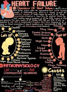 Aorta Anatomy, Cardiology Humor, Cardiology Notes, Medical Terminology Study, Interventional Cardiology, Learn Biology, Cardiac Nurse