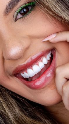 Beautiful Teeth, Celebrity Plastic Surgery, Under The Knife, Dental Cosmetics, The Kardashians, Most Expensive, Famous Celebrities