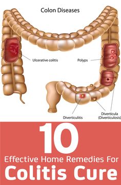 Colon Cleanse Recipe, Top 10 Home Remedies, Constipation Remedies, Colon Cleansing, Colon Detox, Colon Health, Natural Colon Cleanse, Colon Cleanse