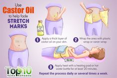 stretch marks 3 Strech Marks, Stretch Mark Remedies, Top 10 Home Remedies, Stretch Mark Removal, Daily Routines, Skin Tightening, Castor Oil, Diy Beauty