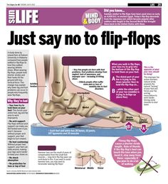 A study done by researchers at Auburn University in Alabama compared how people walked in flip flops to how they walked wearing athletic shoes. When wearing flip flops, people took shorter strides and their heels hit the ground with less vertical force. This change may explain why lower leg and foot problems can occur in people who frequently wear flip flops. Physiotherapy Knowledge, Flat Feet Exercises, Podiatry Clinic, Achilles Tendon, Nursing Student Tips, Spine Health, Foot Soak, Iyengar Yoga, Yoga Therapy