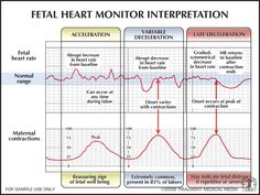 a diagram showing the stages of heart monitoring