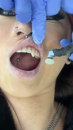 Dentist Reveals The Secrets To Viral Vampire Teeth! 🧛🦷 Permanent Vampire Teeth, Vampire Teeth Body Mod, Pretty Teeth Black Women, Anime Dentist