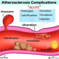 the diagram shows what is in the stomach and how does it help to get ridulition?