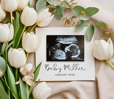 a baby announcement with tulips and an x - ray image on it next to a bouquet of flowers