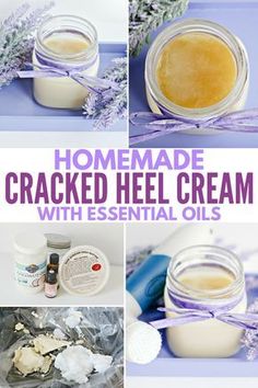 Homemade Foot Cream, Peppermint Lotion, Cracked Heel, Săpunuri Handmade, Homemade Lotion, Cracked Heels, Homemade Bath Products, Homemade Remedies, Foot Cream