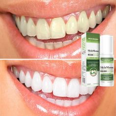 Arc Teeth Whitening Pen, Bright Teeth, Baking Soda Teeth, Baking Soda Teeth Whitening, Baking Soda Toothpaste, Plaque Teeth, Natural Mouthwash, Whitening Teeth, Teeth Whitening Remedies