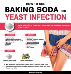 Treat Yeast Infection, Yeast Infection Symptoms, Yeast Overgrowth, Baking Soda Uses, Baking Soda Shampoo, Diet Keto, Natural Home Remedies, Natural Treatments, Nutrition Tips