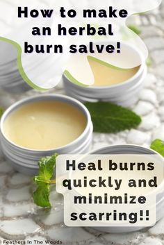 How to make a burn salve from herbs that will actually help the skin heal faster! Antibacterial. I used this salve on a burn and it was completely gone within 2 months! It's easy to make and only requires a few ingredients, but works great on mild burns. Help your skin heal naturally with this natural ointment, don't hinder it with chemicals! Burn Salve, Curling Iron Burn, Herbal Salve Recipes, Iron Burn, Herbal Medicine Recipes, Salve Recipes, Holistic Recipes, Herbal Salves