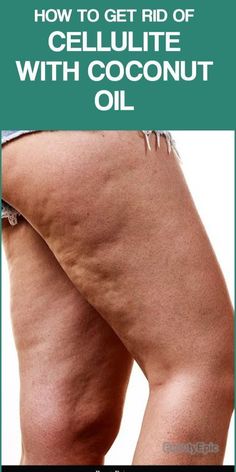 It is easy to get rid of the cellulite. It can be done at home by using coconut oil. Here we will discuss how. Toned Tummy, New Skin, Easy Workouts, Fat Burning, Skin Care Tips, Coconut Oil, How To Use, Hair Hair, Acne